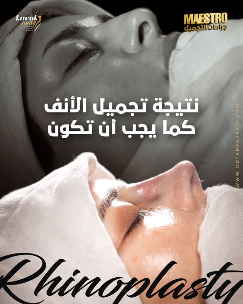 افضل دكتور تجميل انف في مصر 2026